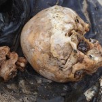 Day 37 Super Typhoon Yolanda – Mass Grave at Basper, a Concert, and Mosquito Torment A skull and the spine of a typhoon victim at the Basper mass gravesite near Tacloban