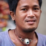 Man With Breathing Tube in His Throat